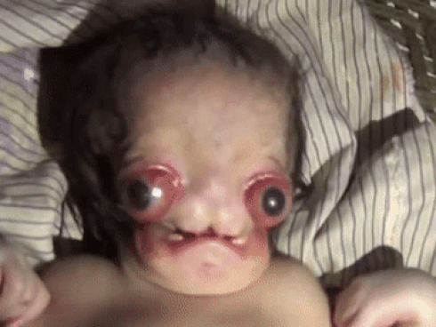 Sinh con tại nhà, bố mẹ thất kinh khi đứa bé ra đời mang gương mặt người ngoài hành tinh-1