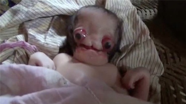 Sinh con tại nhà, bố mẹ thất kinh khi đứa bé ra đời mang gương mặt người ngoài hành tinh-2