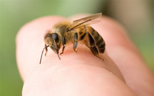 Bị ong đốt nên làm thế nào? Đây là cách xử lý bạn nên biết phòng khi cần dùng đến