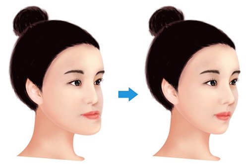 thong tin moi nhat vu nguoi phu nu nguy kich sau phau thuat got cam o sai gon - 1