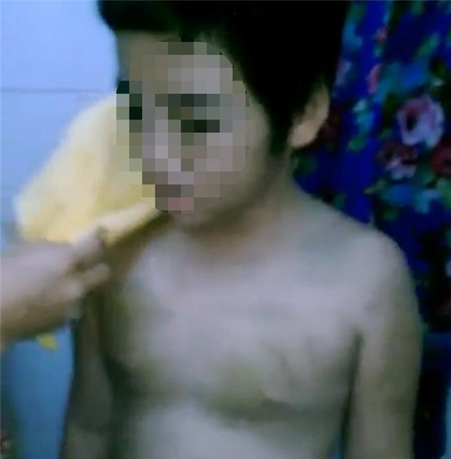 Bạo hành, Bạo hành trẻ em, Vĩnh Long