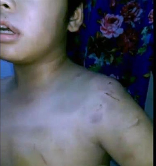 Bạo hành, Bạo hành trẻ em, Vĩnh Long