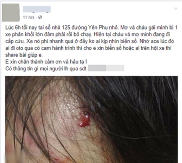 Xác định nam thanh niên tông bé gái 11 tháng tuổi trầy xước mặt rồi bỏ chạy - Ảnh 1.