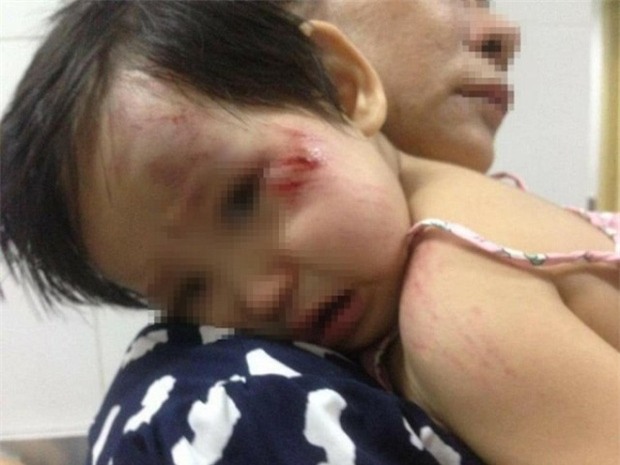 Xác định nam thanh niên tông bé gái 11 tháng tuổi trầy xước mặt rồi bỏ chạy - Ảnh 3.