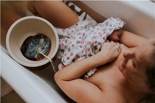 canh bao moi nguy hiem tu trao luu khong cat day ron cho tre so sinh - 2