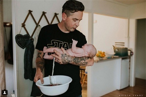 canh bao moi nguy hiem tu trao luu khong cat day ron cho tre so sinh - 3