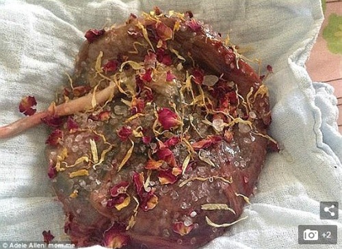 canh bao moi nguy hiem tu trao luu khong cat day ron cho tre so sinh - 4