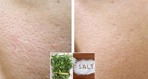 mach ban 2 cong thuc se khit lo chan long cuc hieu qua chua den 10 ngan dong - 4