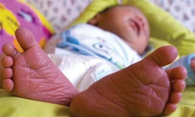 Em bé vừa chào đời, bác sĩ đặt vào túi nhựa trả về cho gia đình chôn cất thì điều ngạc nhiên xảy ra - Ảnh 1.