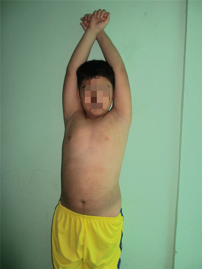 nguoi me bao hanh con trai 9 tuoi nhap vien len tieng - 2