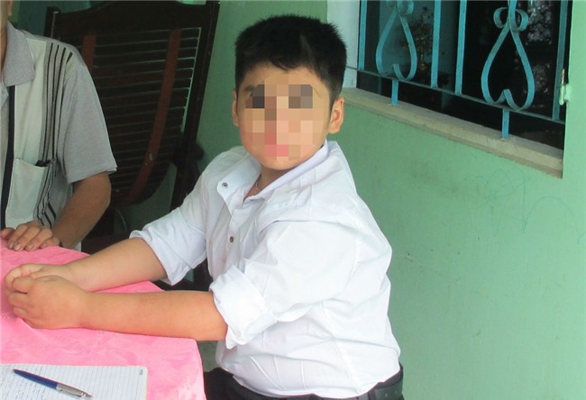 nguoi me bao hanh con trai 9 tuoi nhap vien len tieng - 5