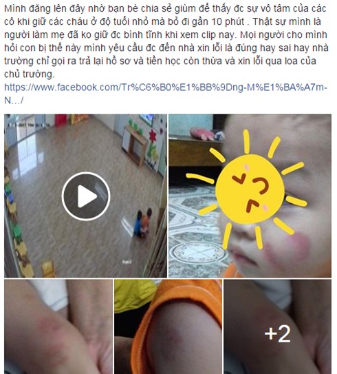 Hà Nam: Phụ huynh tố giáo viên mầm non bỏ lớp khiến các cháu cào nhau rách mặt - Ảnh 2.