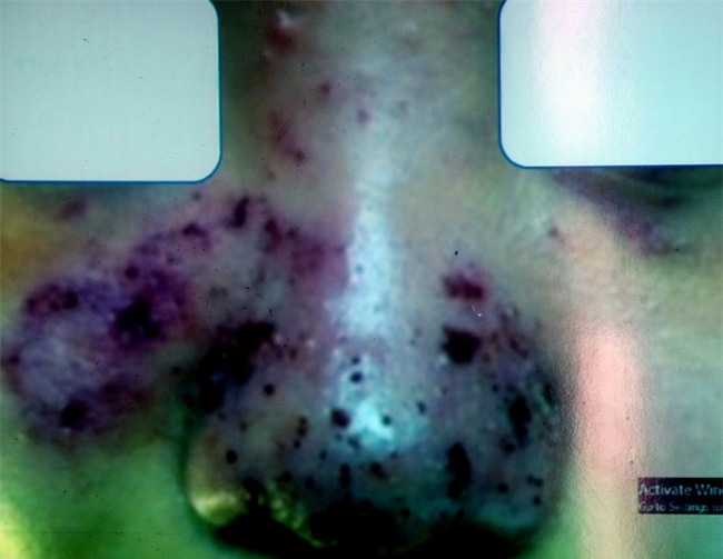 Hai phụ nữ đi làm đẹp “chui”: Người suýt hỏng mũi, kẻ bị biến dạng gò má - Ảnh 2.