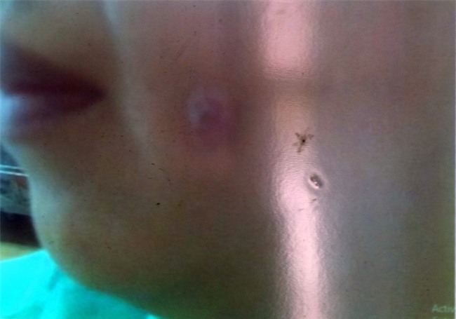 Hai phụ nữ đi làm đẹp “chui”: Người suýt hỏng mũi, kẻ bị biến dạng gò má - Ảnh 4.