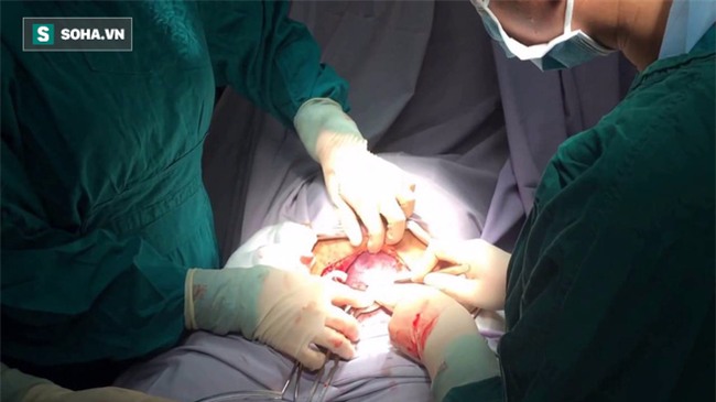 Lén ăn cháo trước khi lên bàn mổ, thai phụ tử vong: Vì sao phải nhớ nhịn ăn trước khi mổ? - Ảnh 2.