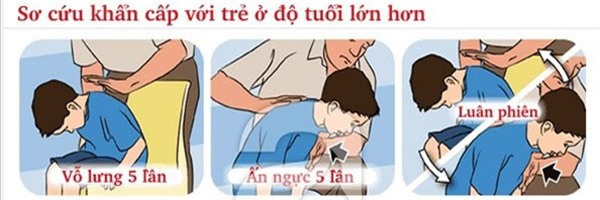 tu vong do sac chao: neu biet cach cap cuu kip thoi co the cuu mang tre - 1