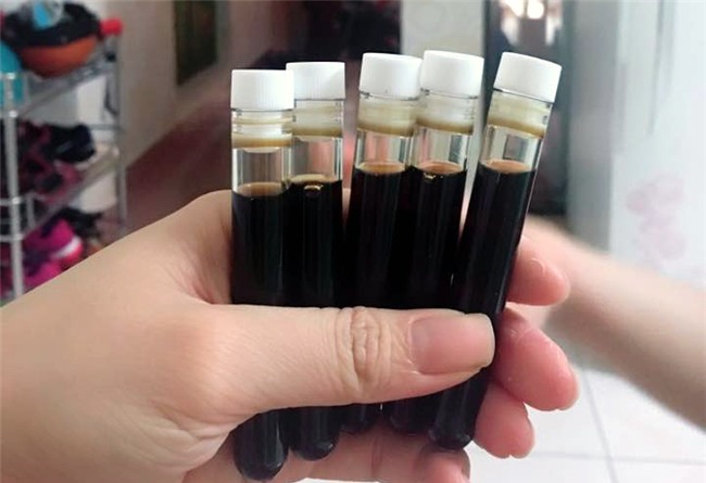 trị mụn, làm đẹp, thuốc nam, cách làm đẹp da