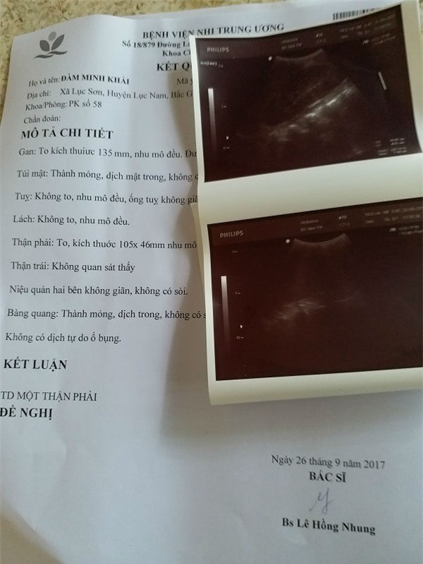 be trai 10 tuoi, nang 14kg an mai khong no vi co “he tieu hoa” de ngoai da - 2