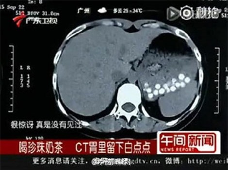 Nhạp nhèm thuong hiẹu trà sũa khong rõ nguòn góc, chỉ nguòi uóng thiẹt!