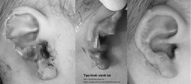 sang nha hang xom choi, chau be 18 thang tuoi bi cho can nat tai - 1