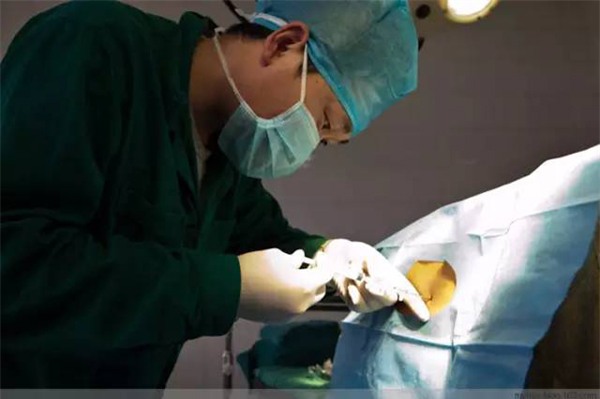 khi dau de ai cung doi mo nhung me co biet mot ca sinh mo dau don the nao khong? - 1