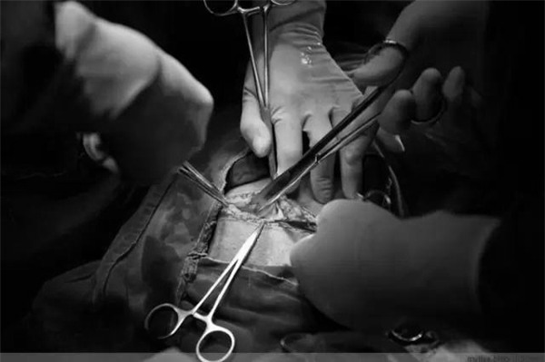 khi dau de ai cung doi mo nhung me co biet mot ca sinh mo dau don the nao khong? - 11