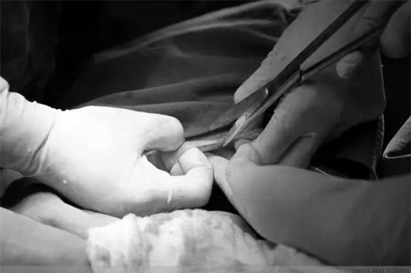 khi dau de ai cung doi mo nhung me co biet mot ca sinh mo dau don the nao khong? - 13