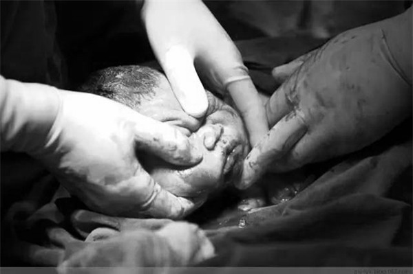 khi dau de ai cung doi mo nhung me co biet mot ca sinh mo dau don the nao khong? - 15