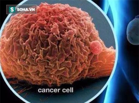 BS cảnh báo ung thư bàng quang đã gặp ở người trẻ: Đi tiểu gặp dấu hiệu này phải khám ngay - Ảnh 1.