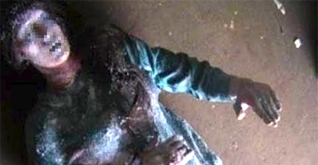 Tưởng chừng như bị đông cứng ngoài trời -33 độ C, cô gái bất ngờ sống lại khiến mọi người sửng sốt - Ảnh 2.