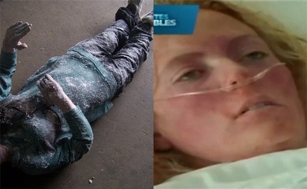 Tưởng chừng như bị đông cứng ngoài trời -33 độ C, cô gái bất ngờ sống lại khiến mọi người sửng sốt - Ảnh 3.