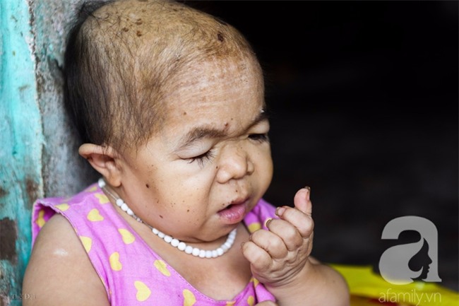 Cuộc đời cô gái gần 30 vẫn mang hình hài của đứa trẻ 2 tuổi: Lủi thủi trong nhà cả đời, không có bạn cùng - Ảnh 10.