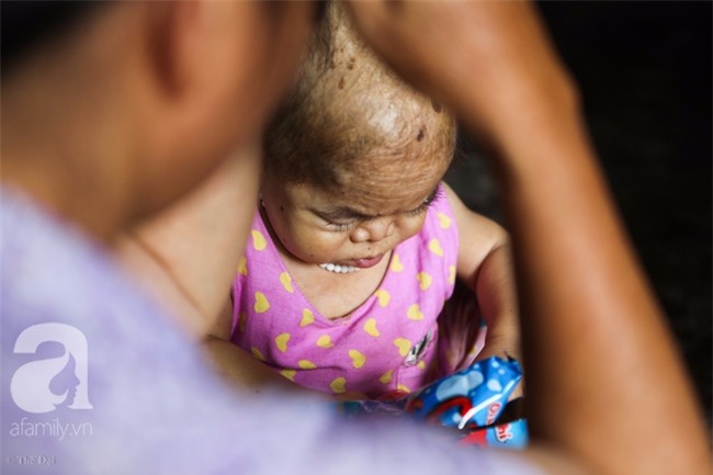 Cuộc đời cô gái gần 30 vẫn mang hình hài của đứa trẻ 2 tuổi: Lủi thủi trong nhà cả đời, không có bạn cùng - Ảnh 11.