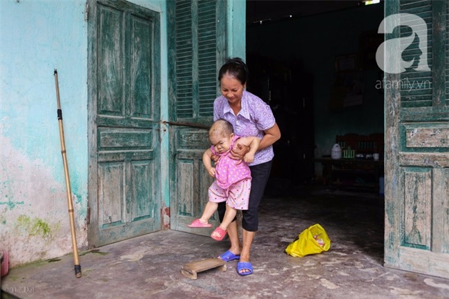 Cuộc đời cô gái gần 30 vẫn mang hình hài của đứa trẻ 2 tuổi: Lủi thủi trong nhà cả đời, không có bạn cùng - Ảnh 13.