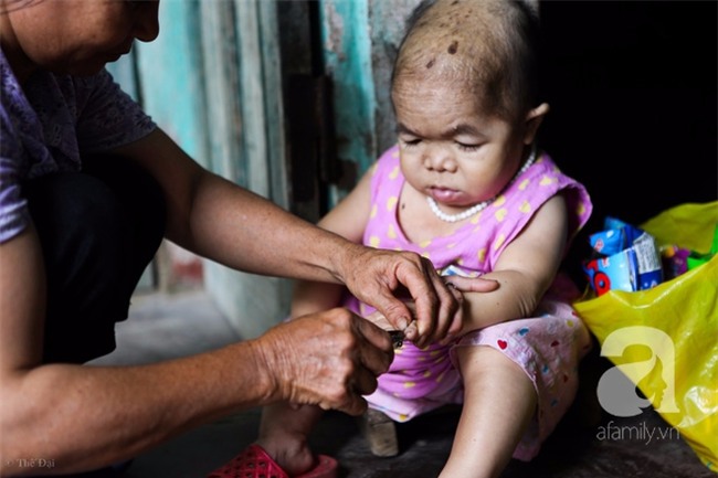 Cuộc đời cô gái gần 30 vẫn mang hình hài của đứa trẻ 2 tuổi: Lủi thủi trong nhà cả đời, không có bạn cùng - Ảnh 14.