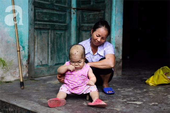 Cuộc đời cô gái gần 30 vẫn mang hình hài của đứa trẻ 2 tuổi: Lủi thủi trong nhà cả đời, không có bạn cùng - Ảnh 2.