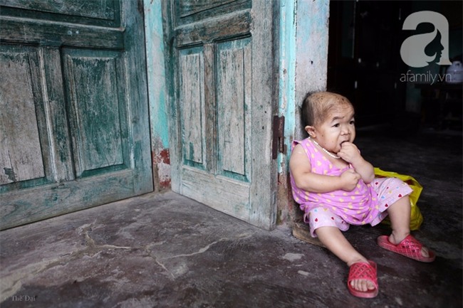 Cuộc đời cô gái gần 30 vẫn mang hình hài của đứa trẻ 2 tuổi: Lủi thủi trong nhà cả đời, không có bạn cùng - Ảnh 6.