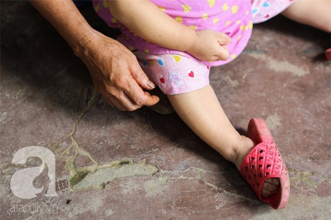 Cuộc đời cô gái gần 30 vẫn mang hình hài của đứa trẻ 2 tuổi: Lủi thủi trong nhà cả đời, không có bạn cùng - Ảnh 7.