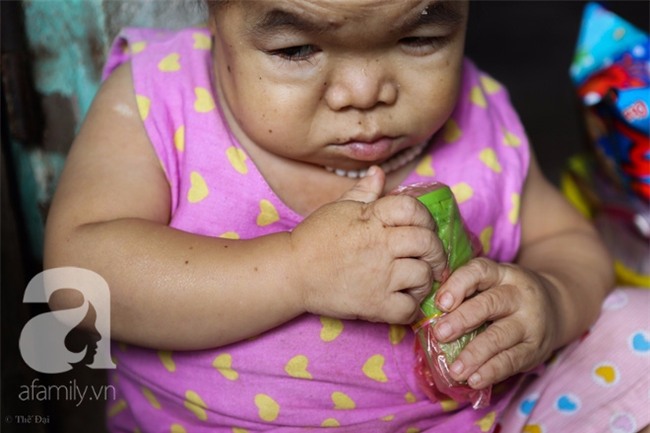 Cuộc đời cô gái gần 30 vẫn mang hình hài của đứa trẻ 2 tuổi: Lủi thủi trong nhà cả đời, không có bạn cùng - Ảnh 8.