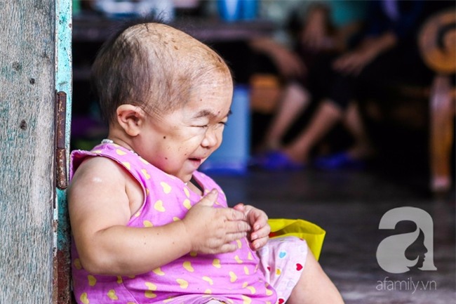 Cuộc đời cô gái gần 30 vẫn mang hình hài của đứa trẻ 2 tuổi: Lủi thủi trong nhà cả đời, không có bạn cùng - Ảnh 9.