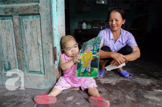 Cuộc đời cô gái gần 30 vẫn mang hình hài của đứa trẻ 2 tuổi: Lủi thủi trong nhà cả đời, không có bạn cùng - Ảnh 17.