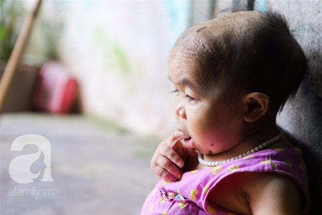 Cuộc đời cô gái gần 30 vẫn mang hình hài của đứa trẻ 2 tuổi: Lủi thủi trong nhà cả đời, không có bạn cùng - Ảnh 20.