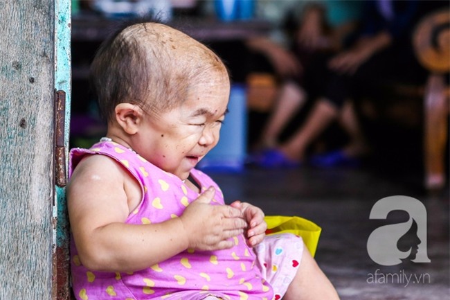 Cuộc đời cô gái gần 30 vẫn mang hình hài của đứa trẻ 2 tuổi: Lủi thủi trong nhà cả đời, không có bạn cùng - Ảnh 22.