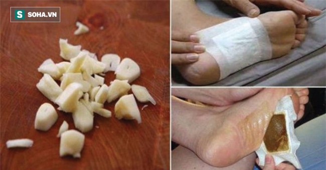 Học phương pháp thải sạch chất độc khỏi cơ thể của người Nhật chỉ sau một đêm - Ảnh 2.