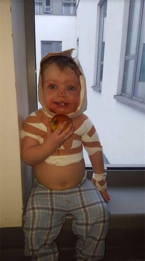 Con trai bị bỏng khi làm đổ nước nóng vào người, mẹ hành động trong hoảng loạn khiến con đau đớn hơn - Ảnh 1.