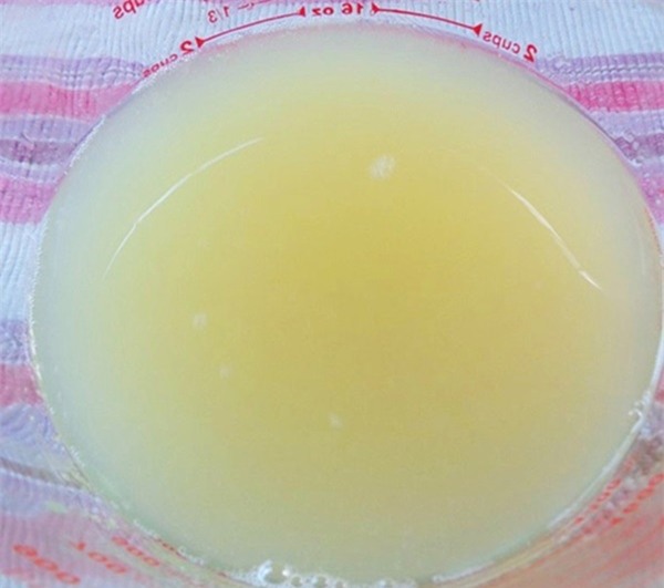 dep-blogtamsuvn153_1