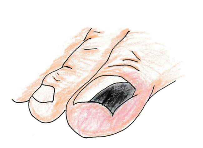 chu quan voi 13 trieu chung sau day la ban dang coi thuong benh ung thu - 11