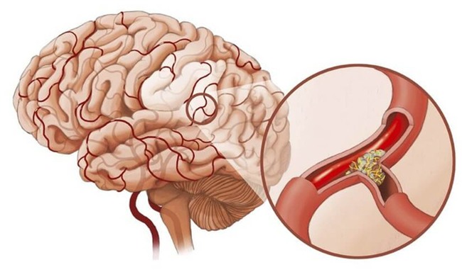 Mạch máu thông thì cơ thể khỏe: GS nổi tiếng khuyên bạn 5 điều nên làm để tránh tử vong - Ảnh 1.