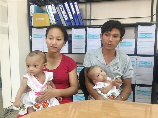 cuoc song moi cua hai be gai song sinh dinh lien mong, khong co hau mon sau hon 1 nam - 1