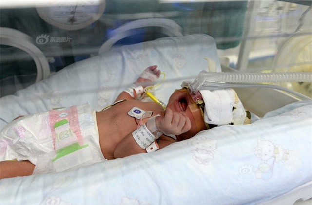 nguoi dan hoang hot thay san phu ngat xiu ben 2 con sinh doi con day ron - 5